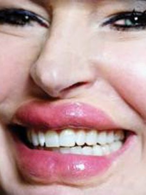 Lip/Tuck 3D FX Transfers - Small By Tinsley Transfers